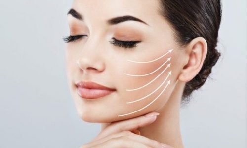 cheek_lift_1400x933-e1540581574161