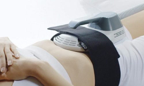 emsculpt-btl emsculpt-btl