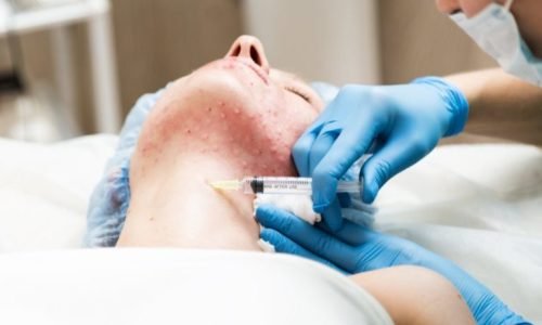opisanie-metodiki-biorevitalizaciya-shei-i-dekolte-820×615-768×576 opisanie-metodiki-biorevitalizaciya-shei-i-dekolte-820x615-768x576